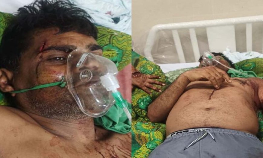 कुल्हाड़ी से हमला: गाली-गलौज का विरोध करने पर पूर्व जनपद सदस्य प्रतिनिधि पर जानलेवा वार